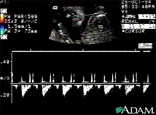 ultrasound_heartbeat.jpg