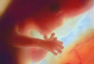 12_week_fetus-300x204.jpg